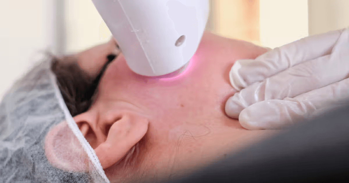 Maintenance regimens following procedural dermatology​