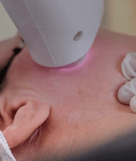 Maintenance regimens following procedural dermatology​